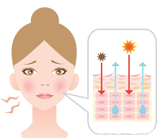 修复 去红血丝用什么护肤品效果好?6款超有效修复红血丝护肤品排行榜