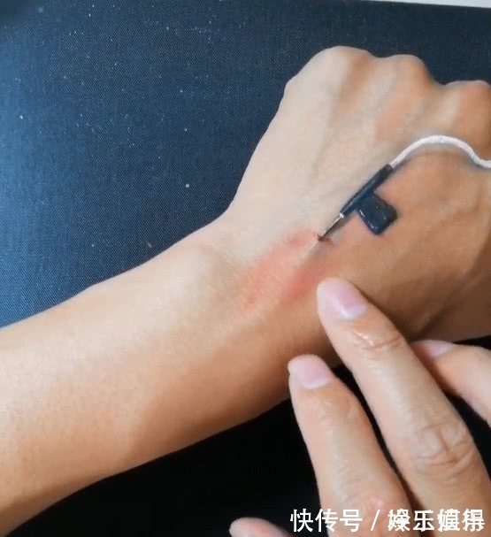 美术生@为了请假实在是太拼了!美术生在手背上造假,看到成品老师笑了