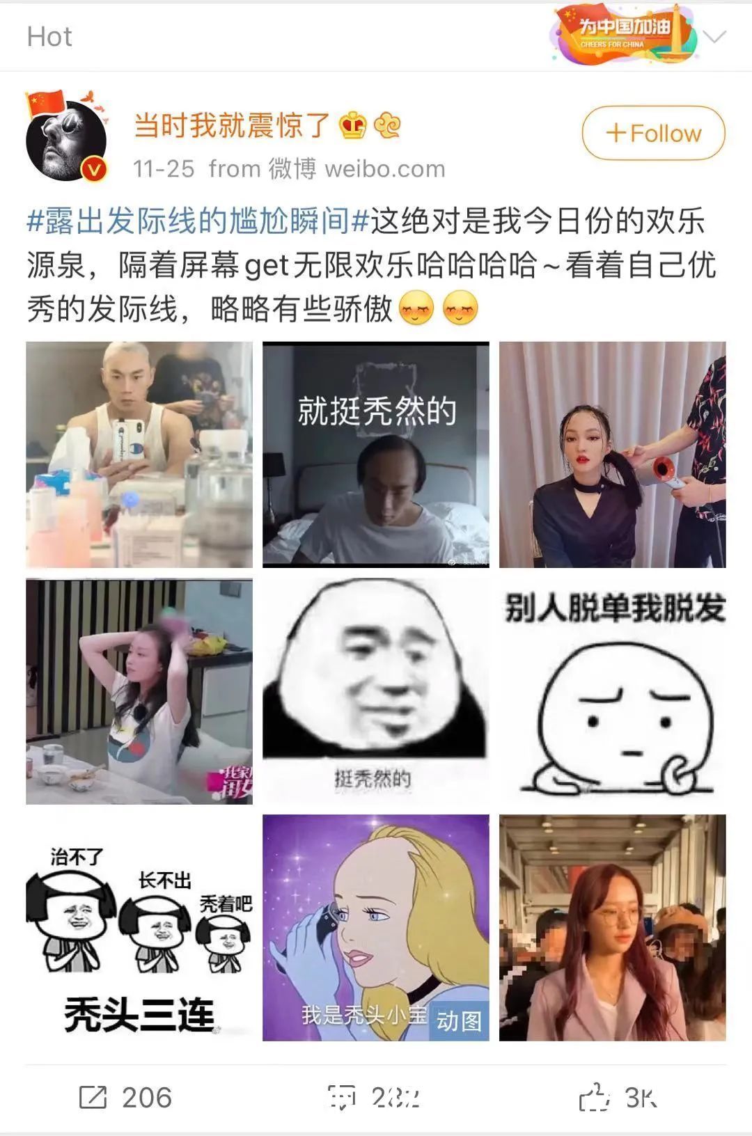  芭姐|为什么别人的美人线，是你害怕露出的发际线？