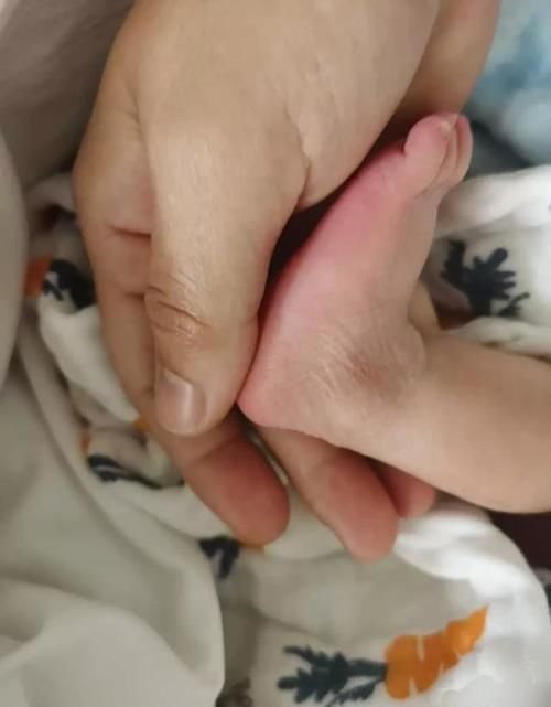 产后康复为何如此重要？