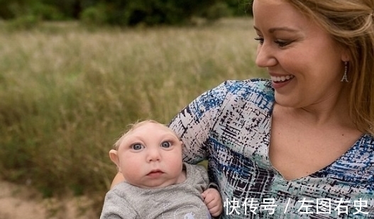 畸形儿|小男孩出生只有“半个脑袋”,好像被削去了,医生:活不过3个月