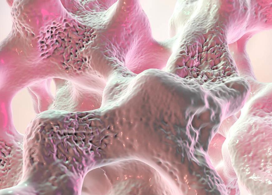 大夫|喝牛奶能预防骨质疏松？骨科大夫：大错特错，真正有用的常做3事