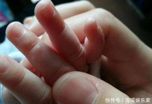 部位|孩子这三个部位“短”,将来可能不会高,希望你的孩子一个都没中