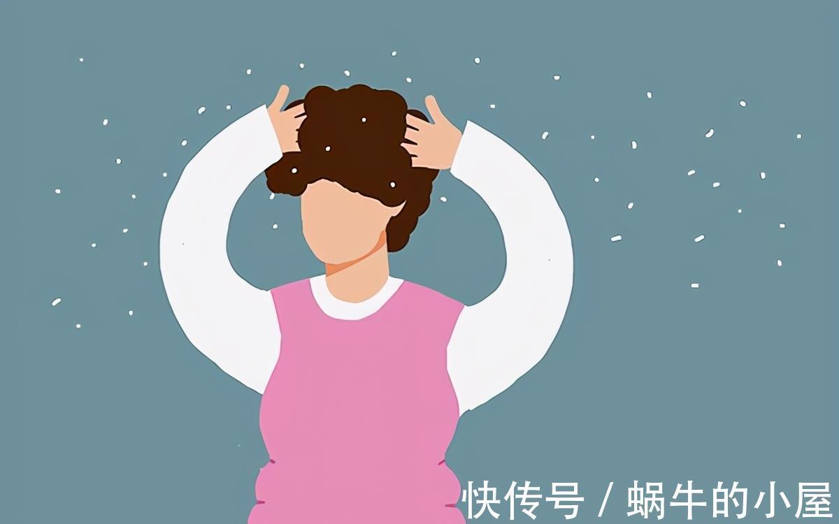 油脂|大把大把的头皮屑,是什么原因?如何才能去除?医生告诉你