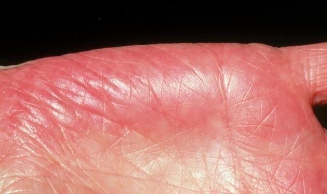 开水|养肝“冠军”找到了,不是菊花,开水里丢一把,肝病靠边站