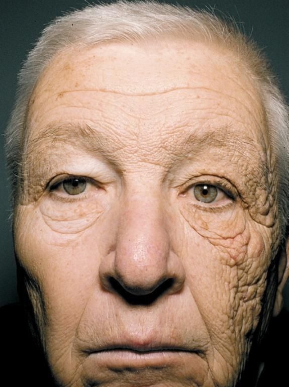 防晒 坚持用了“4年”防晒霜,皮肤发生了“大改变”,不止变白了!