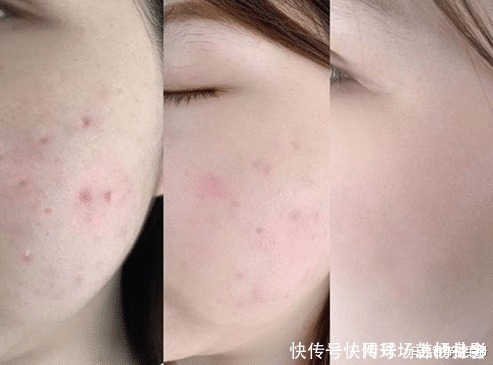 口红|买家秀与卖家秀“区别太大”,不是因为你没模特的五官,而是皮肤