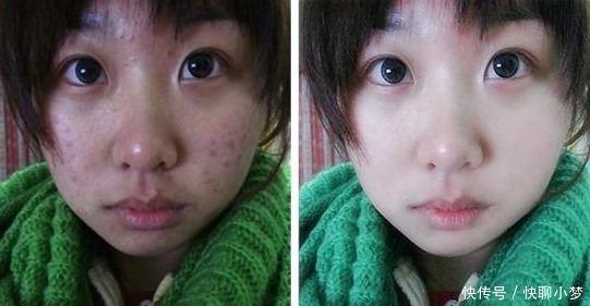 产品|皮肤科医生提醒:这几款火爆全网的护肤品,含有刺激性激素