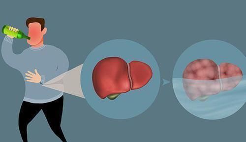 雄激素是男性魅力标志,做什么能补回雄激素显得更年轻