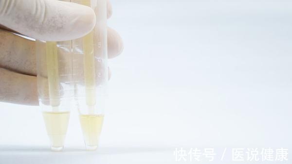 肾小管|糖尿病患者,肾脏受损后,排尿会有5种表现,当心尿毒症已来临