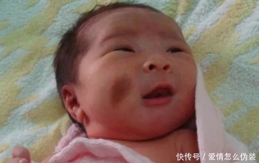 化妆品|胎记来源于孕期习惯？准妈妈们这3种恶习，会导致胎儿被胎记缠身