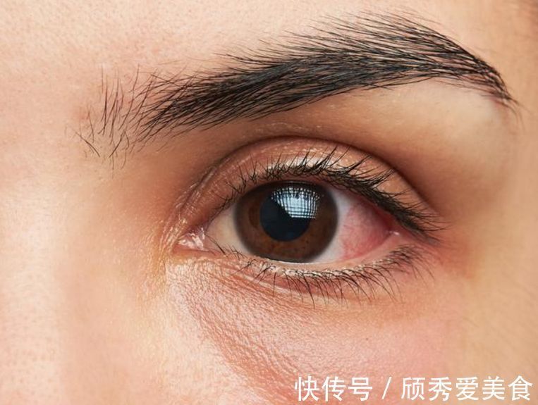 金银花|5个信号一出现,肝火“烧”起来了,自己动手,给肝“去去火”