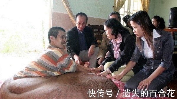 男子|男子的腿长成了一块“大岩石”，天天坐在上面，画面让人害怕