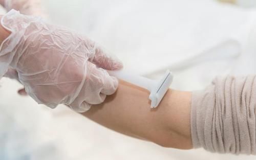 雌激素|为啥有些女性体毛旺盛，有的却“光秃秃”呢？两者哪种更健康？