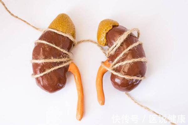 水肿|得了糖尿病,注意这4种表现,是糖尿病肾病的典型症状,需重视