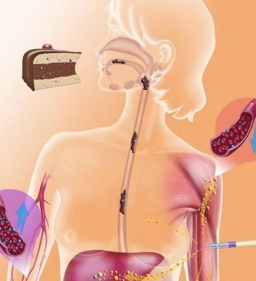 含脂|患了糖尿病只忌糖吗，远离3类饮食，血糖只降不升，快来了解下