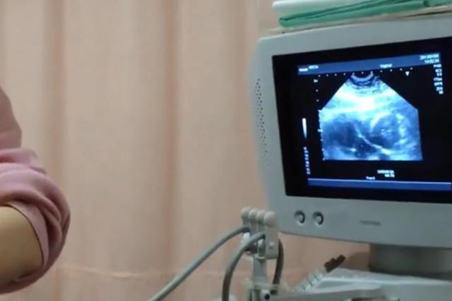 羊水穿刺|准妈妈做“羊水穿刺”现场,老公默默的喊加油,而妈妈已哭成泪人