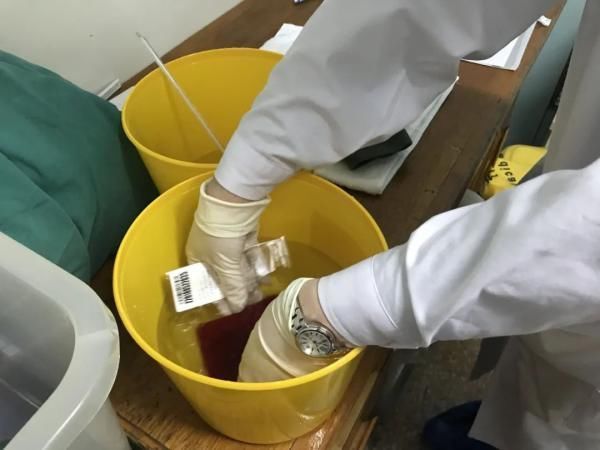 地中海|龙泉驿妈妈3次怀孕,只为存“救命血”救地中海贫血症大女儿