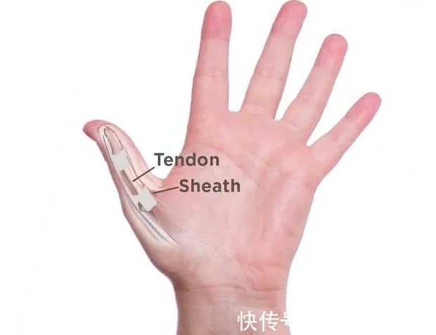 疼痛|为什么更年期的女性出现各种疼痛?该咋办?请看此文,医生告诉您