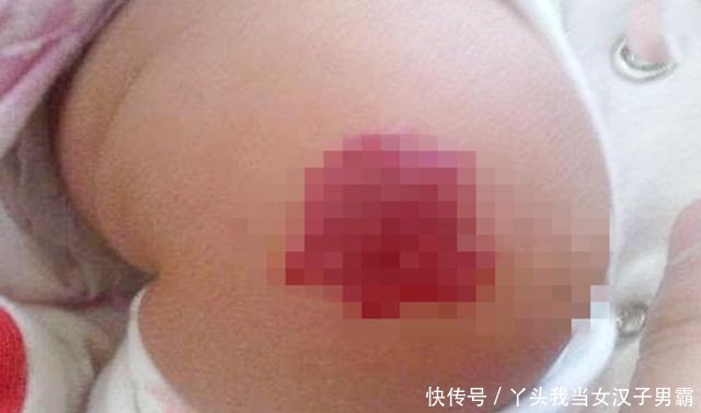 这三种行为会导致娃出生后有“胎记，”不想宝宝有，孕妈最好别做！