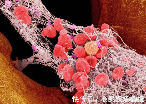 人的一生|到了一定年龄血液黏稠,通常会有4个表现,如果你一个不占很健康