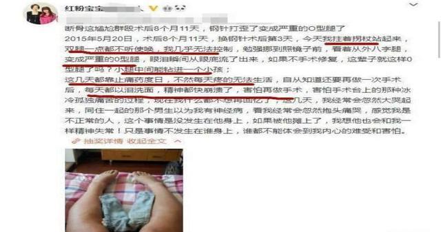 现状|花400多万做200次整容手术的“红粉宝宝”,现状让令人唏嘘