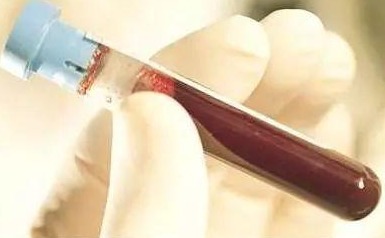 血尿酸|各年龄血压、血糖、血脂、血尿酸对照表，果断收藏，以备不时之用