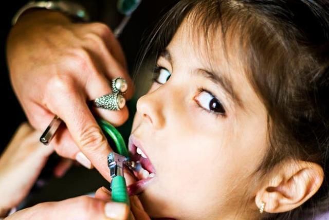 罪魁祸首|10个5岁儿童中,7个有龋齿,罪魁祸首居然不是糖?