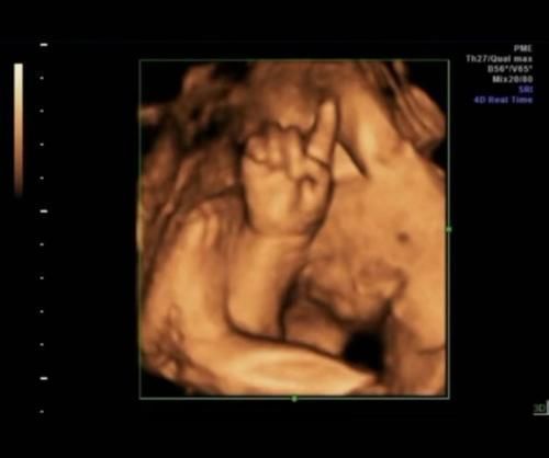产妇|产妇产检做“四维”，胎儿在子宫里“数数”医生：下一个数学天才