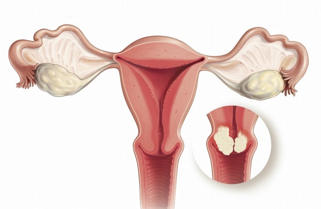 行为|3个同房行为,小心女人宫颈成筛子,男人别再沾沾自喜