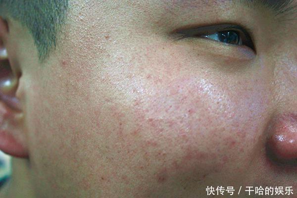 男性雄激素不足,身体会发出哪些信号和哪些因