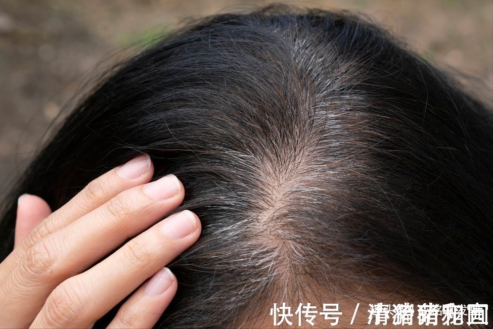 染发 白发多也不要频繁染发,伤发又上头皮,这四个小妙招解决白发困扰
