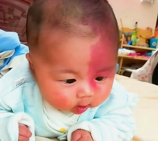 化妆品|孕期这三个行为,容易让胎记找上宝宝,准妈妈需尽量避开