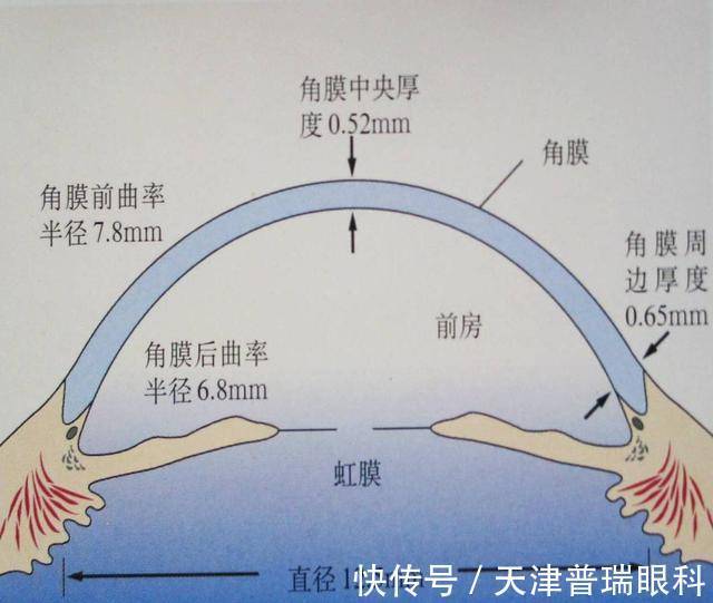 矫正|眼角膜薄可以做近视眼手术吗？