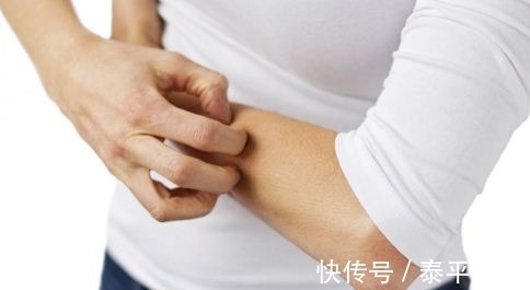 红肿|35岁男子皮肤红肿、破溃半年以为是过敏医生却说是皮肤结核病