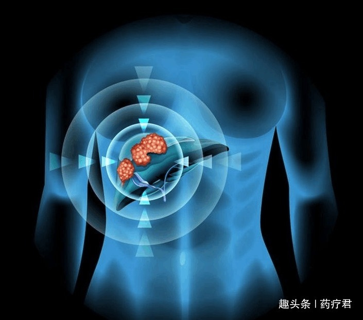 肝癌|多吃西红柿可以预防肝癌新加坡研究了25年，结论出来了