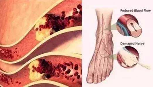 脉搏|血管堵没堵，摸摸脚背就知道了!一个动作，让全身血液流通起来