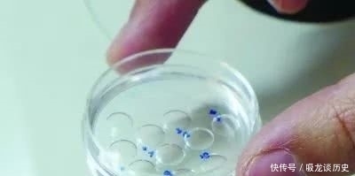 试管婴儿|试管婴儿反复失败问题到底出在哪?该继续还是坚持?