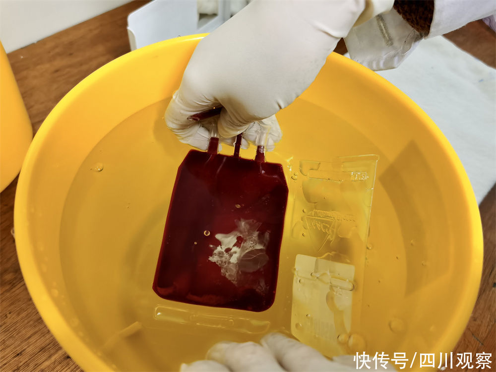 张静|四川首批“脐宝贝”20岁了