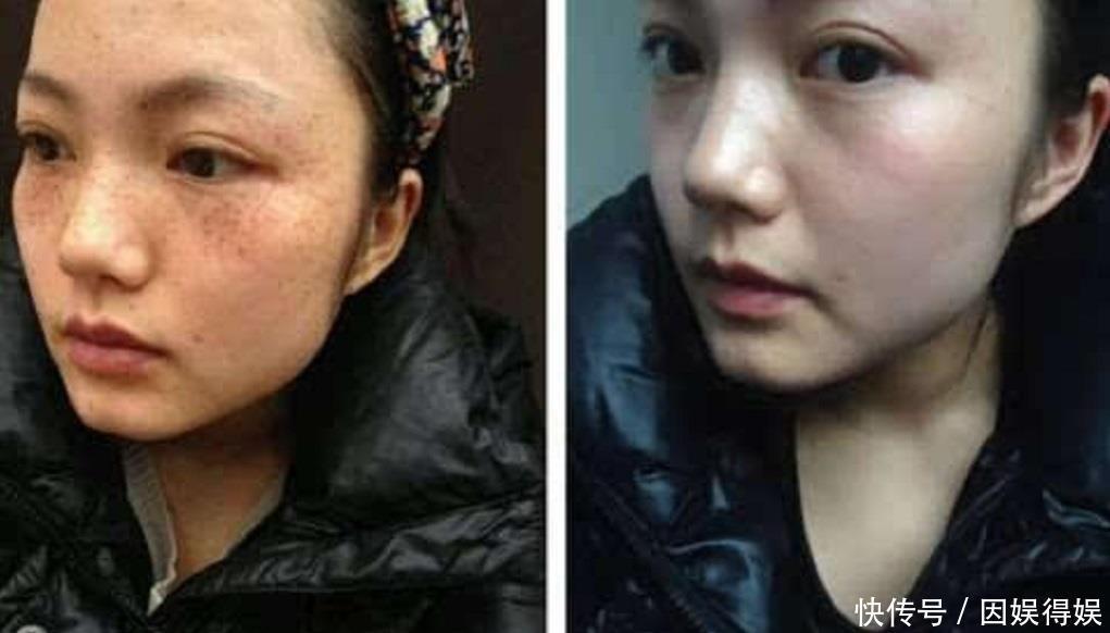 “小苏打”这样用,7天美白嫩肤,20天明显淡斑,色斑妹子不愁了