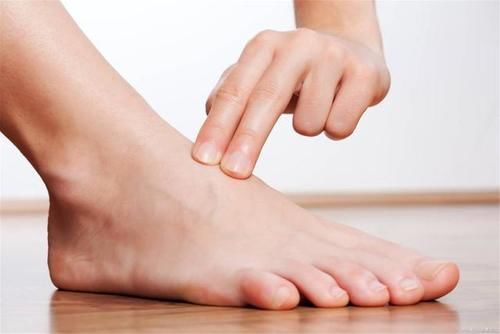 胆固醇类|血脂高，腿先知？腿部有这5个表现，就要注意了，早发现，早治疗