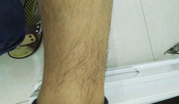 毛发|为什么有的男性腿毛旺盛，有的比女性还“光滑”告诉你准确答案