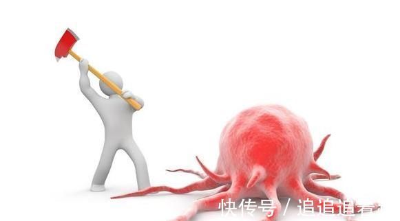 恶性肿瘤|肿瘤的发展，分为5个阶段，到了晚期基本就“无力回天”！