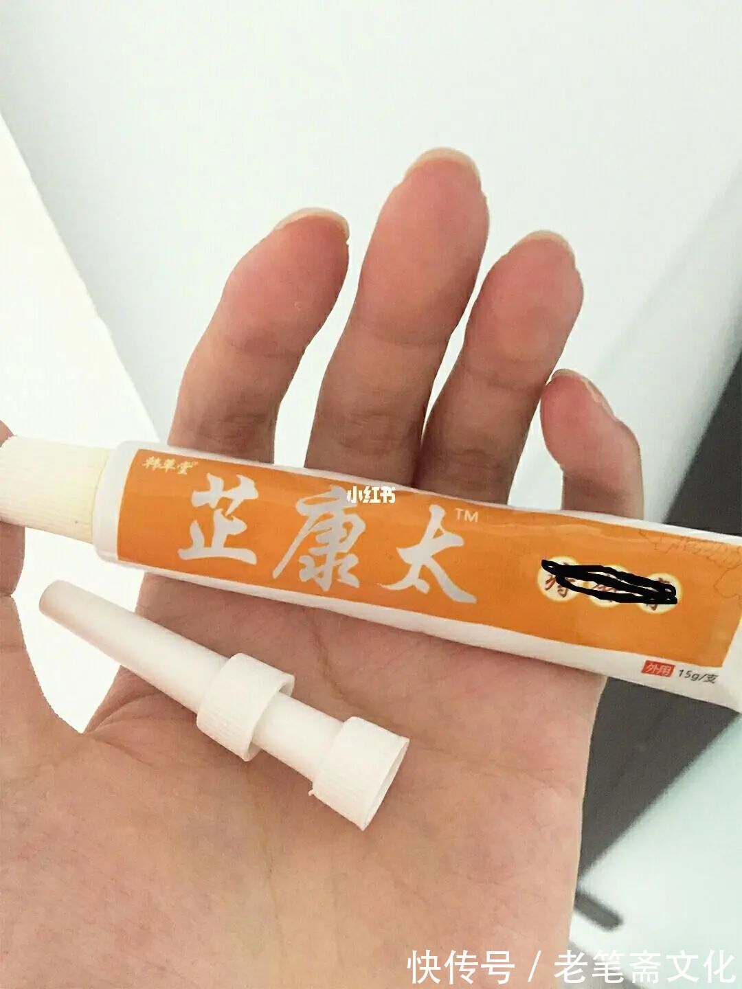 止痛|痔疮久治不愈怎么办?不开刀不塞药,患者亲测快速消除顽固痔疮!