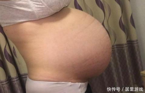 产检|准妈妈太粗略,nt产检时间没选对,被秒拒