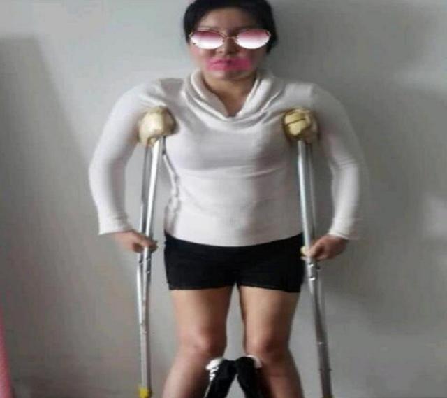 现状|花400多万做200次整容手术的“红粉宝宝”,现状让令人唏嘘