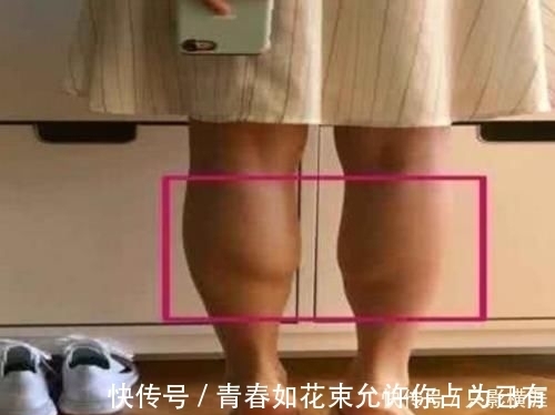 竹竿腿|为何有些女生明明很瘦却“腿粗”教你3招,“竹竿腿”自然来
