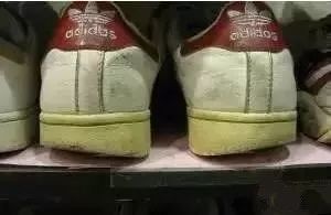 趾甲|看看脚趾头,就大致知道自己的肾好不好,容不容易长寿~