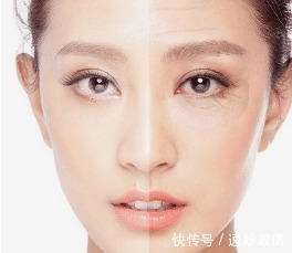 胜过|预防鱼尾纹的4个小妙招,胜过美容术