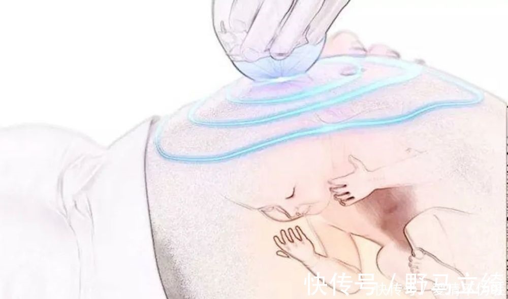 鉴定|一张四维彩超轻松看出胎儿性别,孕妈先别高兴的太早